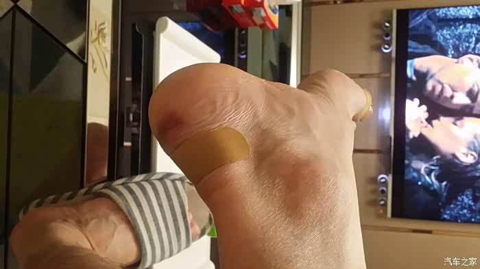 脚趾压伤了,有点疼!