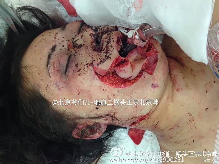 有戏看了动物园作死那女的是专业医闹