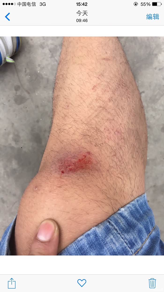 腿卡吐露皮了 真醉了