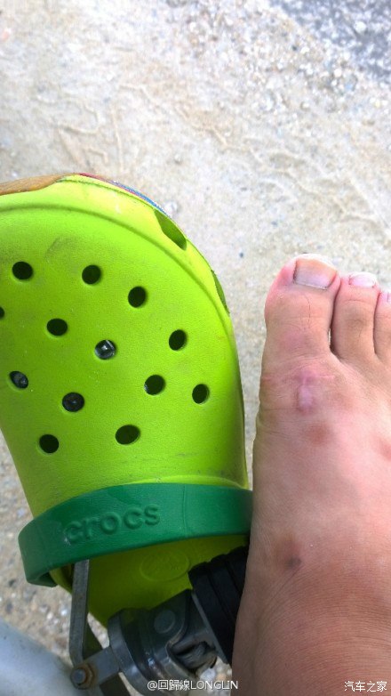 阳光透过洞洞鞋,脚上被晒得一个个洞